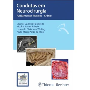 Condutas em Neurocirurgia – Crânio